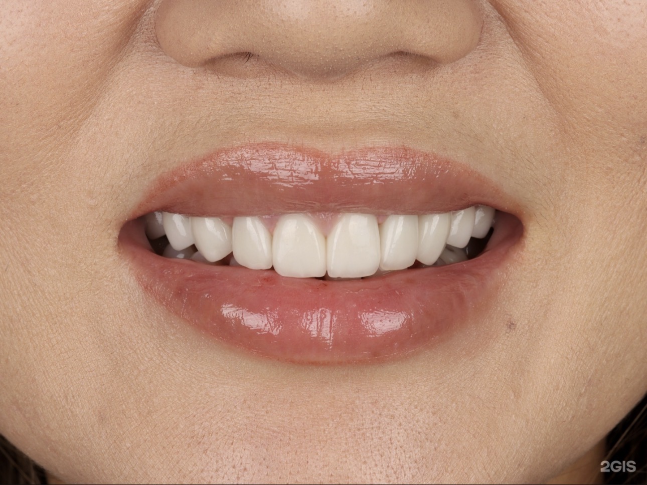 Красивая улыбка